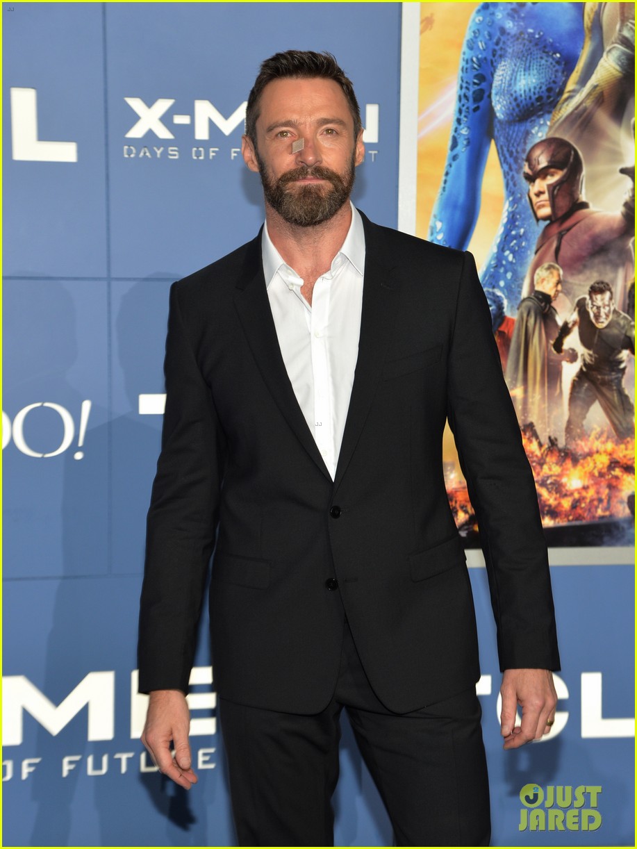 Hugh Jackman Wears Bandage on Nose to 'X-Men' Premiere