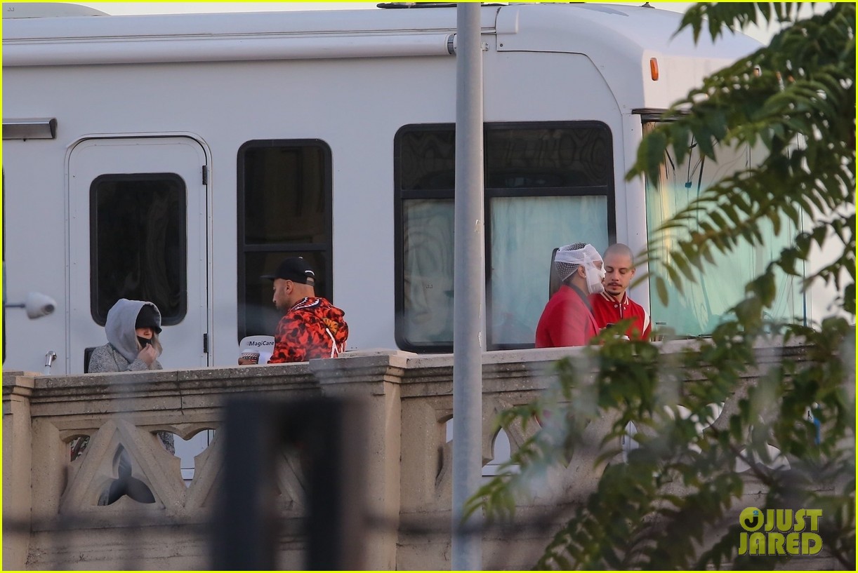 The Weeknd's Head is Covered with Bandages While Filming New Music Video in L.A.